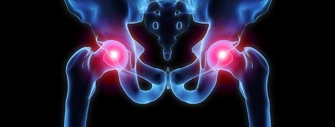 pinnacle hip implant lawsuit bbslawoffices